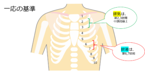 胸腔ドレーン手術