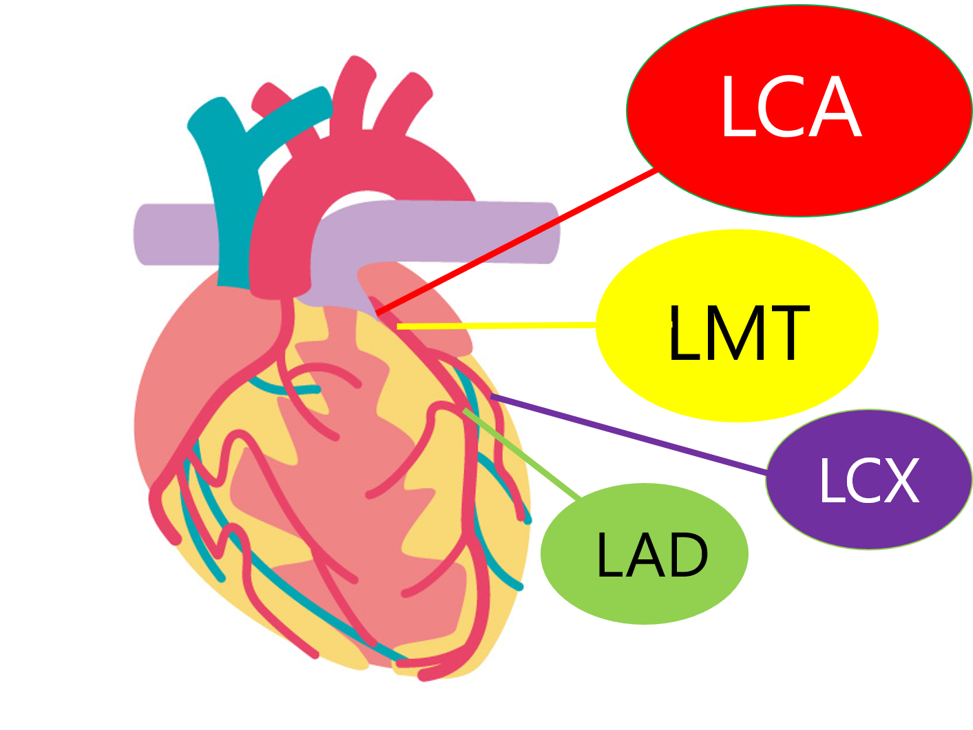 CABG（冠動脈バイパス術）パート① ～各グラフトの特徴＆術式の種類を解説～ | ICU看護師ダンカンの心外ブログ