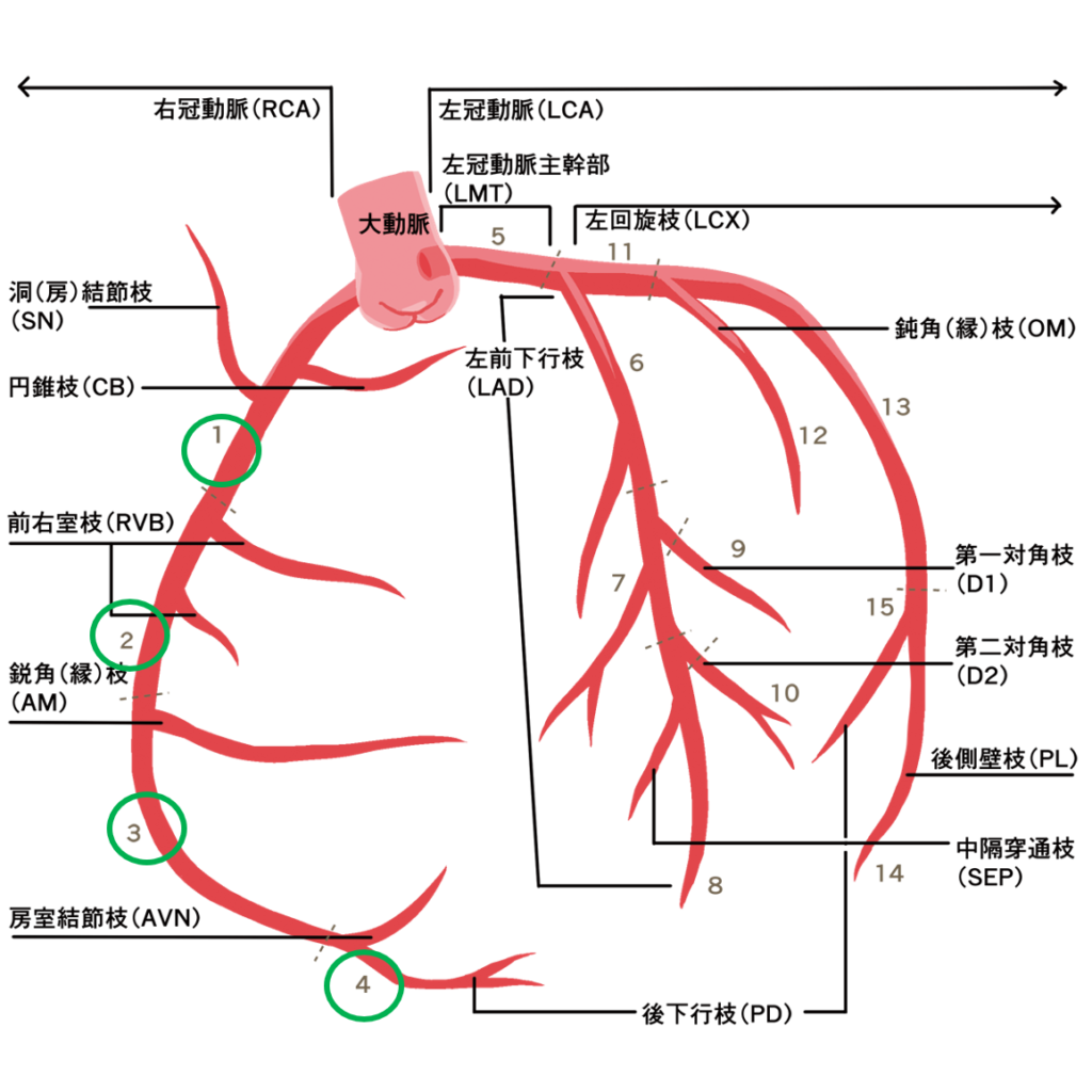 CABG（冠動脈バイパス術）パート①　～各グラフトの特徴＆術式の種類を解説～