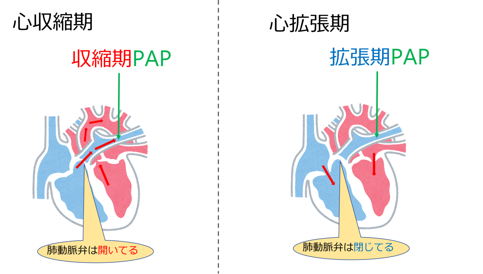 スワンガンツカテーテル治療はなぜ行われるのですか?